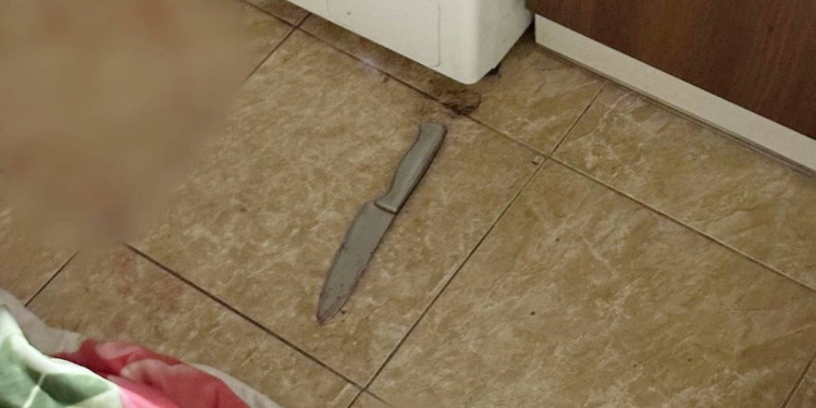 Вдарив співмешканку ножом в шию, а потім намагався збрехати – у Миколаєві затримали чоловіка за замах на вбивство