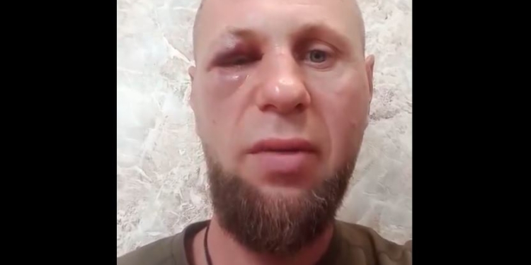 Свавілля у Смілі. Побили пораненого військового, можлива причетність криміналітету, Генпрокурора і міністр МВС в курсі