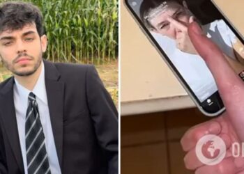 Молодий американець має найдовший в світі великий палець. Що він ним робить? (ВІДЕО)