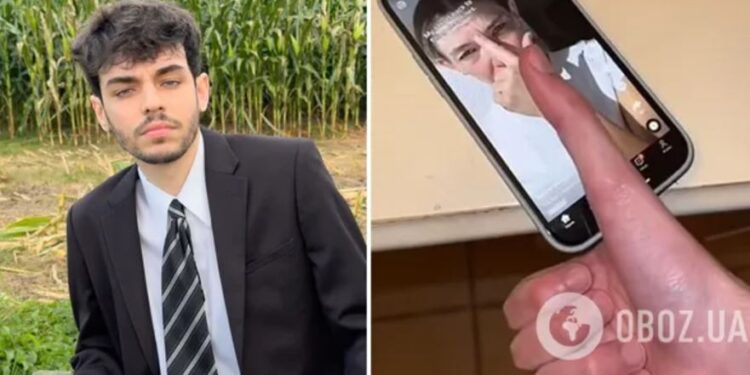 Молодий американець має найдовший в світі великий палець. Що він ним робить? (ВІДЕО)