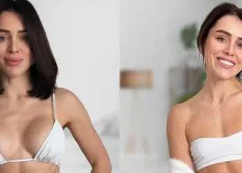 Змінилась мода – українки відмовляються від качиних губ і імплантів у грудях (ФОТО)