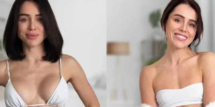 Змінилась мода – українки відмовляються від качиних губ і імплантів у грудях (ФОТО)