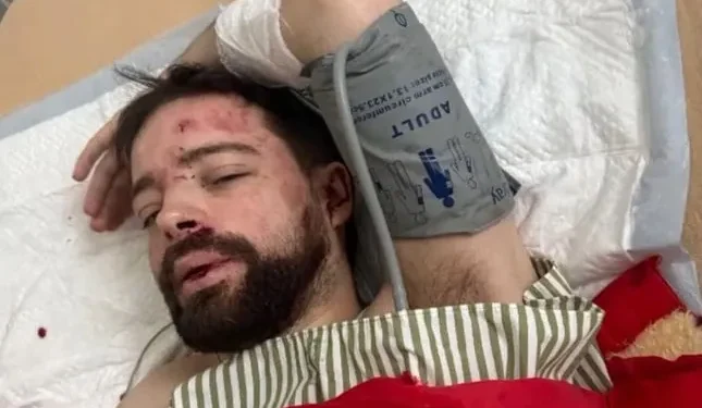 Викладача Львівського університету знайшли побитим та без свідомості під Києвом: що відомо, які питання до ТЦК? (ФОТО)