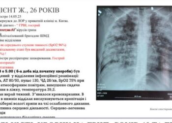Бережіться і бійтеся сьогоднішнього грипу, Голубовська каже – він катастрофічний