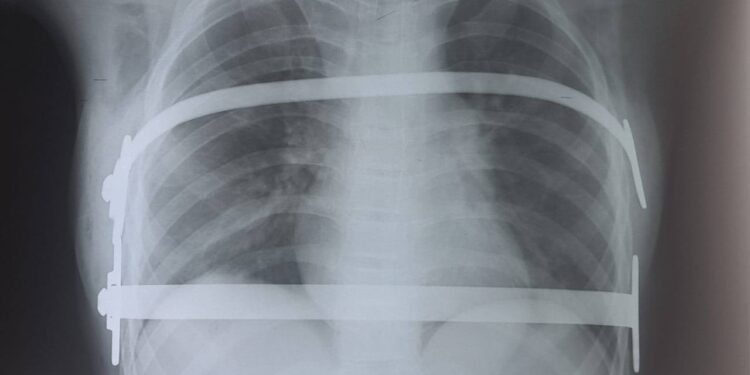 У Миколаєві провели складну операцію 12-річній дитині (ФОТО)