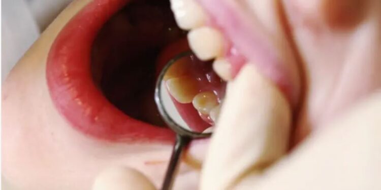 Лікування дитячих зубів під наркозом – справді безпечно? Висновки після трагедії (ФОТО)