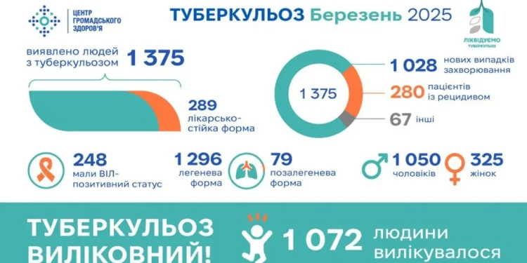 Скільки в Україні виявили хворих на туберкульоз у березні: ЦГЗ озвучив цифри