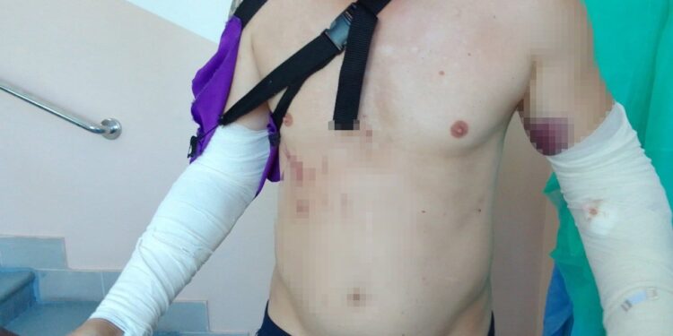 На військовому полігоні інструктор побив новобранця – його госпіталізували (ФОТО)