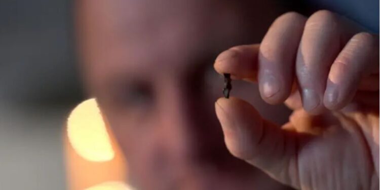 Виклик смерті. Українські хірурги дістають уламки з серця магнітним екстрактором. Що це таке (ФОТО)