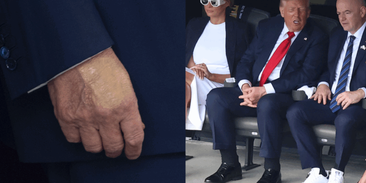 У Трампа виявили венозну недостатність, Білий дім зробив заяву (ФОТО)