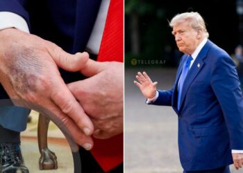 На що насправді хворий Трамп, і як в США приховують хвороби президентів (ФОТО)