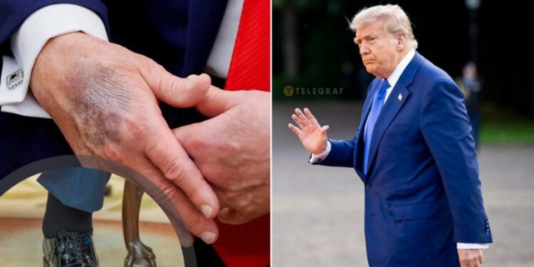 На що насправді хворий Трамп, і як в США приховують хвороби президентів (ФОТО)