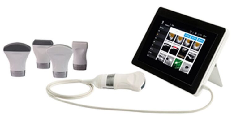 Миколаївщина отримає французькі портативні ультразвукові сканери для повноцінної швидкої діагностики