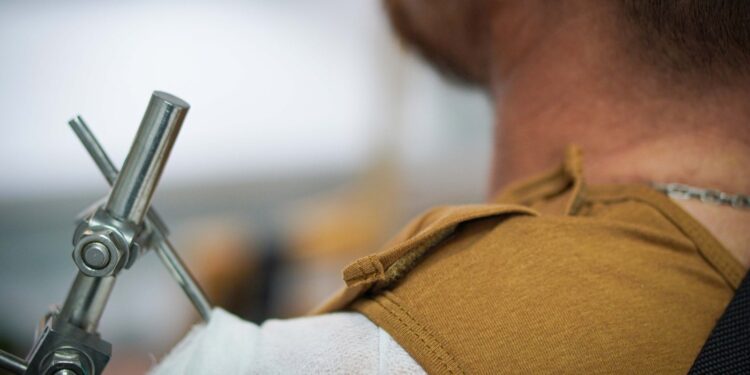 У ЗСУ з’явився адаптивний одяг для поранених – його вже видають (ФОТО)