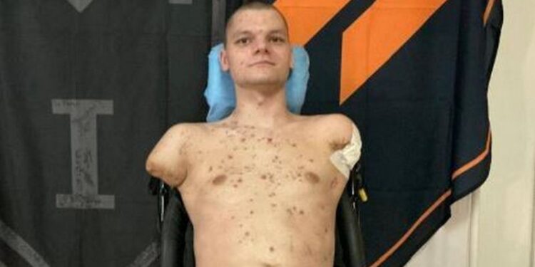 У ПриватБанку воїну без рук і ніг не видали картку. Тепер глава Нацбанку привезе її особисто (ФОТО)