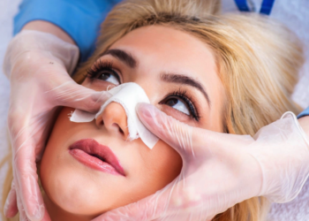 5 лайфхаков как помыть голову после ринопластики