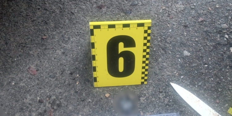 У Миколаєві чоловік отримав удар ножем від знайомого за відмову позичити гроші (ФОТО)