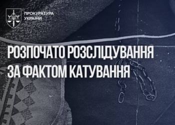 На Дніпропетровщині виявили 7-річного хлопчика на ланцюгу – його посадила на нього рідна мати