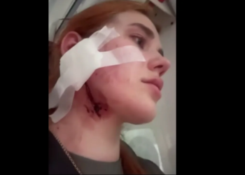 Українців знову побили в Польщі через акцент – у жінки розірване вухо та шия (ВІДЕО)