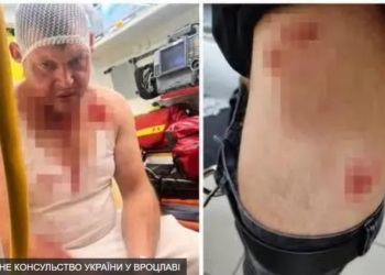 Черговий напад на українців у Польщі. В поліції кажуть – не через національність (ФОТО)