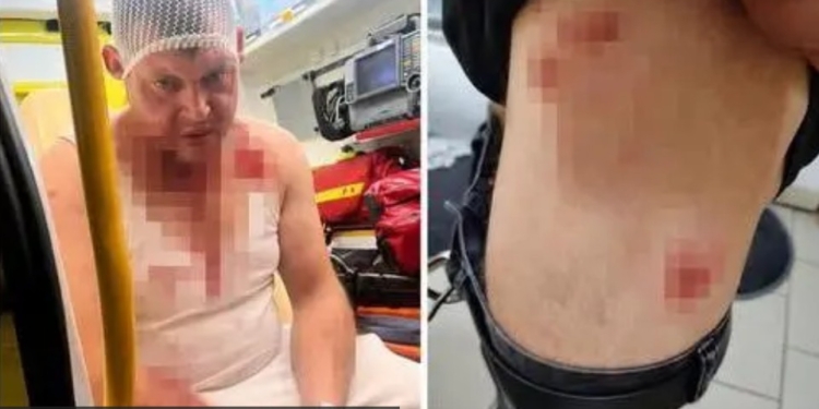 Черговий напад на українців у Польщі. В поліції кажуть – не через національність (ФОТО)