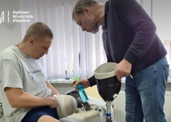 Уряд оновлює умови протезування для людей зі складними ампутаціями