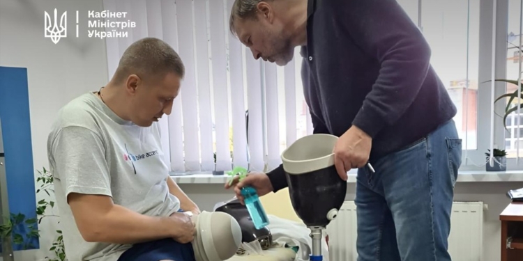 Уряд оновлює умови протезування для людей зі складними ампутаціями